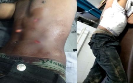 CG में क्रिमिनल मस्त, खाकी पस्तः बदमाशों के हौसले बुलंद, दिन दहाड़े युवक को मारा चाकू, सवालों के घेरे में पुलिसिया सिस्टम